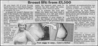 part of the story in the Sunday Mirror about breast uplifts