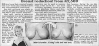 Breast reduction