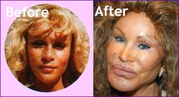 Jocelyn Wildenstein before and after pictures of her cosmetic surgery