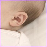 Linda Briggs - ear reshaping