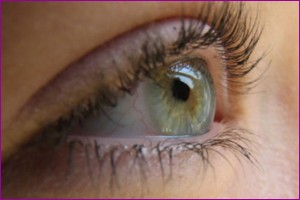 Cataracrs